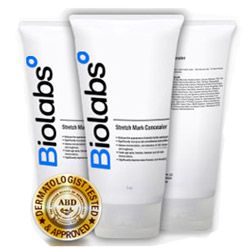 Biolabs Stretch Mark Concealer Benefits